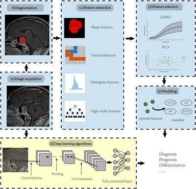 The current state of MRI-based radiomics in pituitary adenoma: promising but challenging